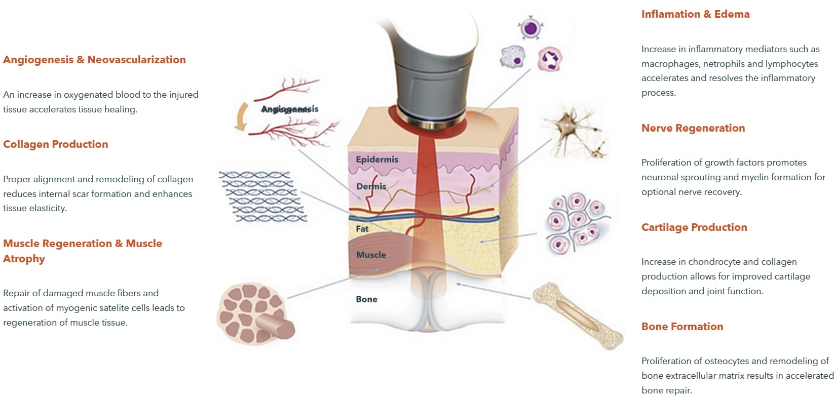 Laser therapy works by stimulating a process called photobiomodulation (PBM) in which photons enter the tissue and interact with the Cytochrome C complex within mitochondria.