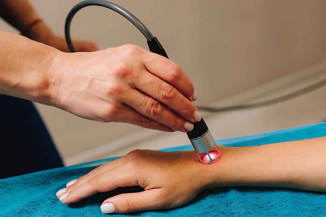 IV Laser therapy over hand.