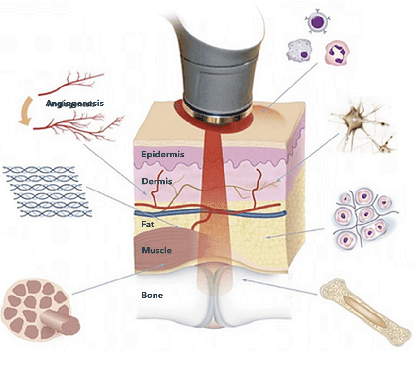 Diagram showing the therapeutic effects of laser light throughout the body
