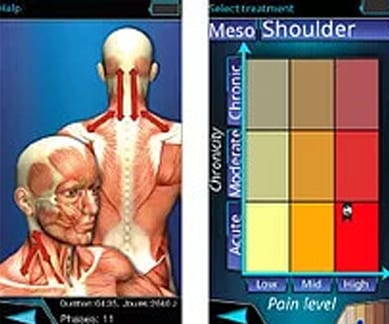 Different Treatments Adapted to Level of Pain