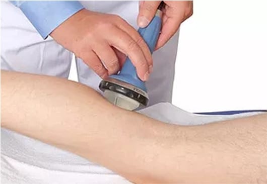 MyACT treatment applied to a patient’s knee